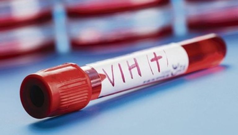 Detectan nueva variante de VIH; sería más agresiva y contagiosa
